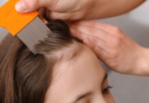 Natural Ways to Repel Lice with Essential Oils